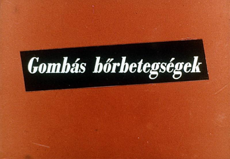 Gombás bőrbetegségek 