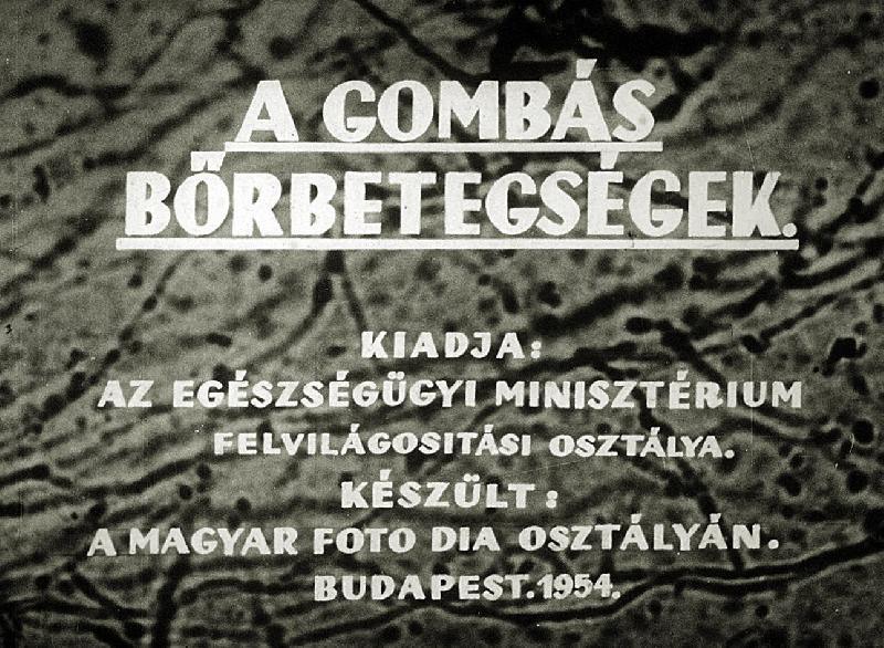 Gombás bőrbetegségek 