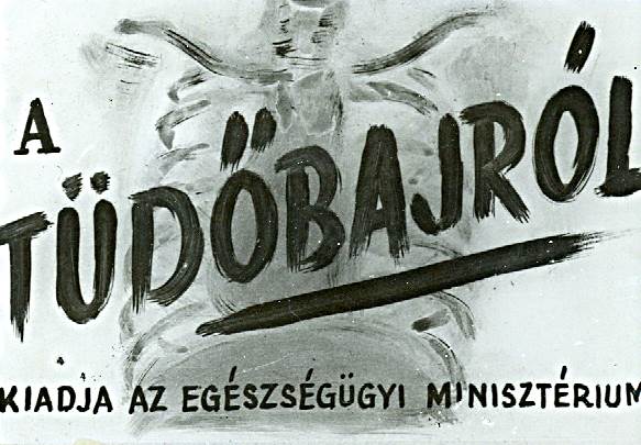 A tüdőbajról