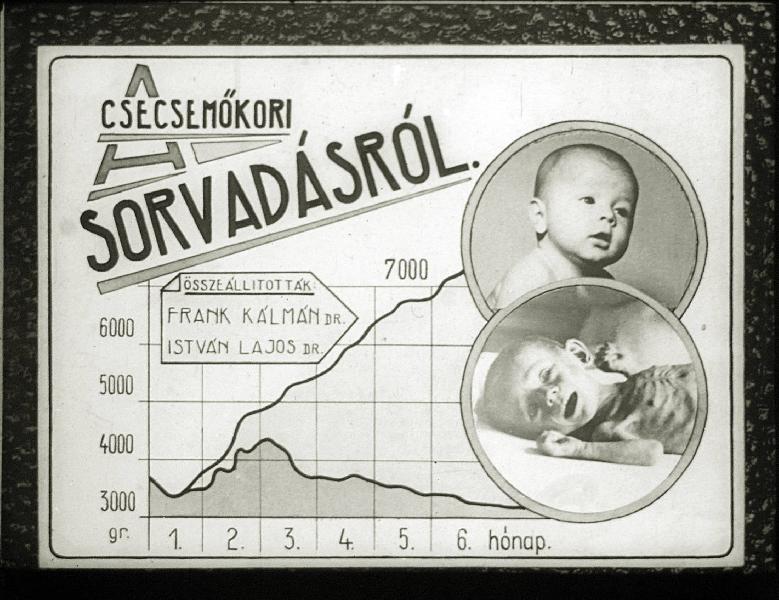 A csecsemőkori sorvadásról