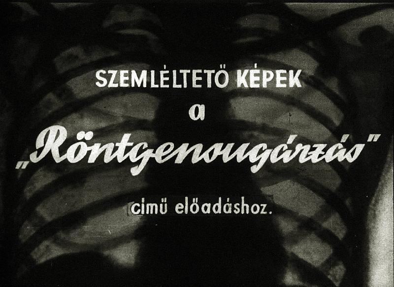 Röntgensugárzás