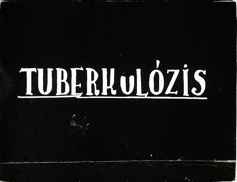 Tuberkulózis